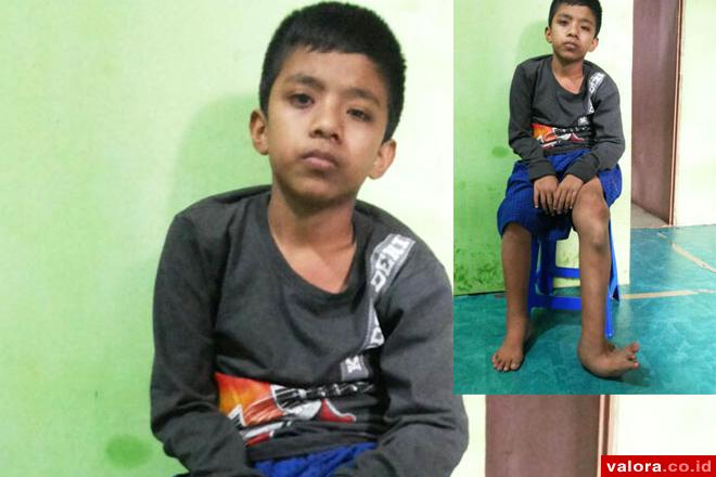 Kondisi terakhir Afriansyah (13), setelah pemeriksaan di Jakarta. Membutuhkan korset penahan tulang punggung dan panggulnya dengan segera untuk melakukan operasi berupa amputasi kaki kiri akibat tumor ganas yang telah menyerang kekebalan tubuhnya. (istime