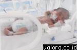 Didiagnosa menderita gula rendah, Barie Ghandur Pratama masih terbaring lemah di inkubator ruangan NICU Rumah Sakit Siti Rahmah. Bayi ini merupakan buah hati perdana dari pasangan suami-istri Hervan Surya (31) dan Farida Hanum (27) asal Limau Manih, Kecam