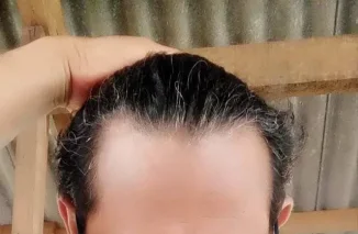 Bukan Media, Tapi Medsos Pejabat: Di Agam, Kominfo Jadi Kreator, Pejabat Jadi Influencer